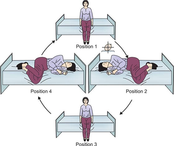 Learn about these exercises before consulting a vertigo specialist near you